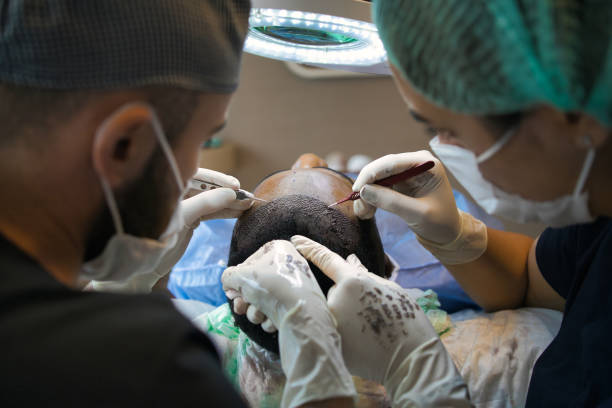 Hair Transplant Questions People Ask Most: Texture, Hormones and Downtime